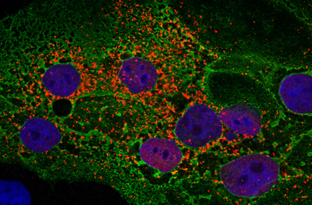 Coronavirus infected cells, under microscope. credit: Dr. Susan Weiss